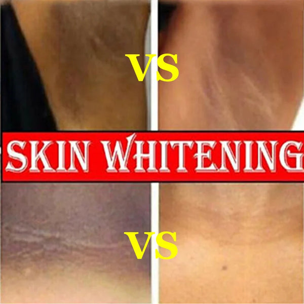 Whitening Skin Lightening Serum